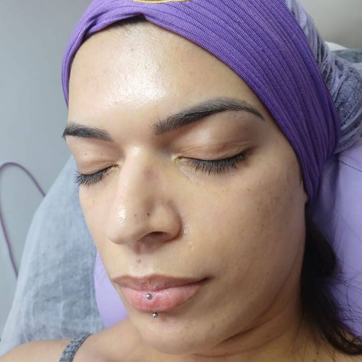 Cliente fazendo limpeza de pele em Paulicéia